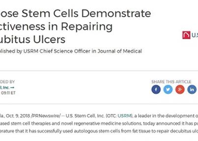 脂肪干细胞有效修复褥疮，不愈伤口逐渐愈合