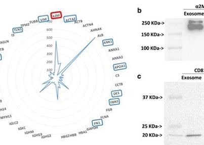 脐带间充质干细胞外泌体促进伤口愈合，未来替代皮肤移植
