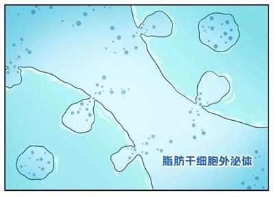 新研究：因辐射造成的皮肤损伤，脂肪干细胞或许有办法！